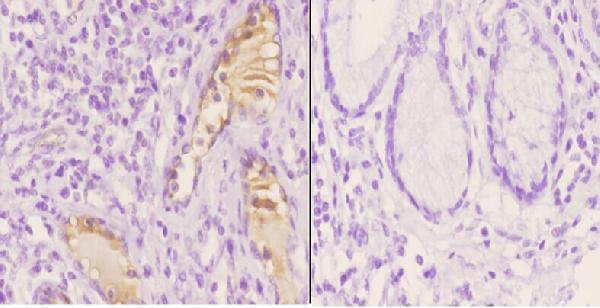 a02767 1 efnb1 primary antiboties ihc testing 2