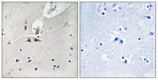 Immunohistochemistry analysis of paraffin-embedded human brain, using Ephrin B1/B2/B3 (Phospho-Tyr324) Antibody