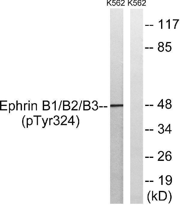 Western blot analysis of lysates from K562 cells treated with serum 20% 15