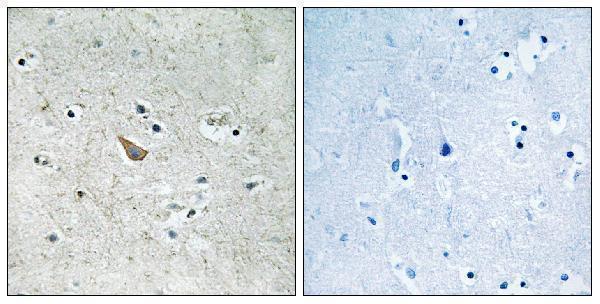 a02767y329 efnb1 primary antibodies ihc testing 2