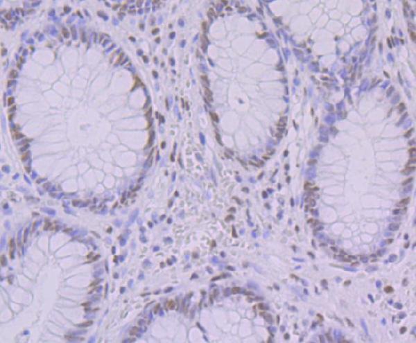 a02770 1 khsrp primary antiboties ihc testing 2