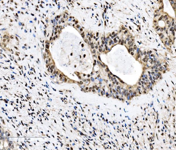 a02770 2 khsrp primary antibodies ihc testing 2