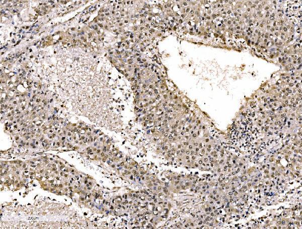 a02770 2 khsrp primary antibodies ihc testing 4