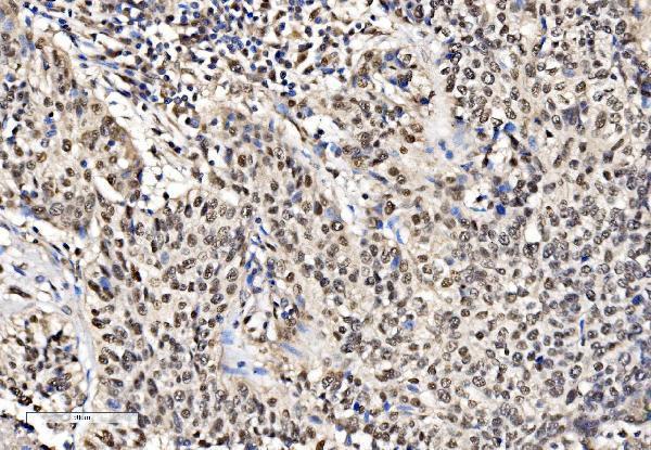 a02770 2 khsrp primary antibodies ihc testing 5