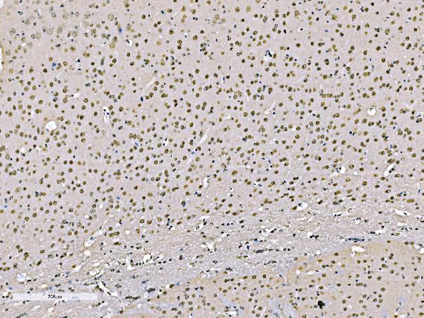 a02770 2 khsrp primary antibodies ihc testing 6