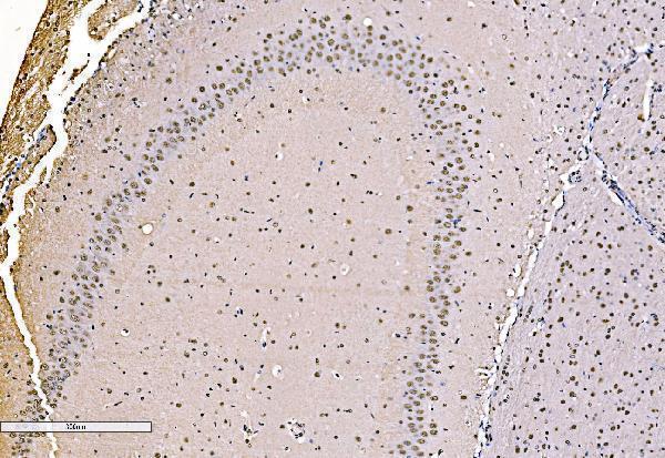 a02770 2 khsrp primary antibodies ihc testing 7