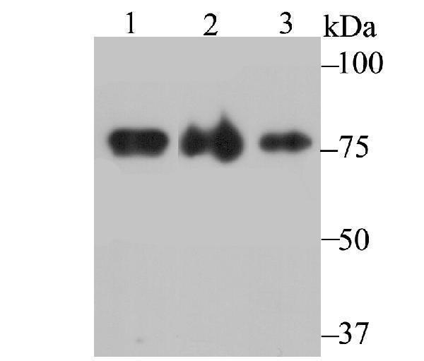 a02770 khsrp primary antiboties wb testing 1