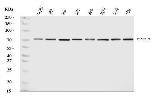  Western blot analysis of RANGAP1 using anti-RANGAP1 antibody (A02771-2)