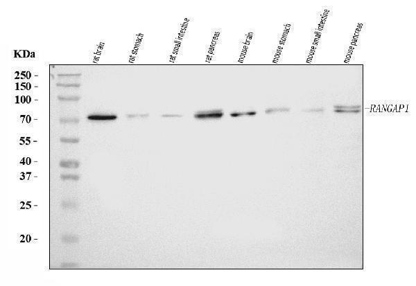  Western blot analysis of RANGAP1 using anti-RANGAP1 antibody (A02771-2)
