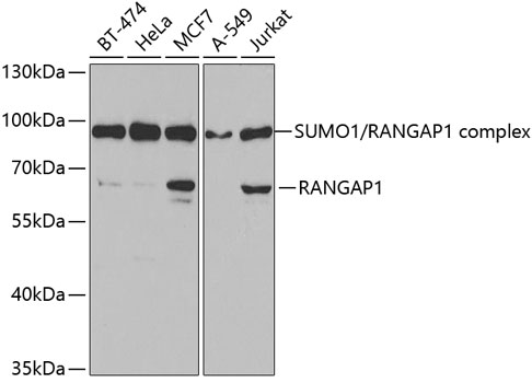a02771 rangap1 primary antiboties wb testing 1
