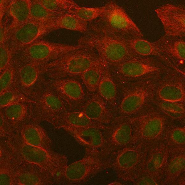  IF analysis of BCL3 using anti-BCL3 antibody (A02773-4) and anti-Beta Tubulin antibody (M01857-3)