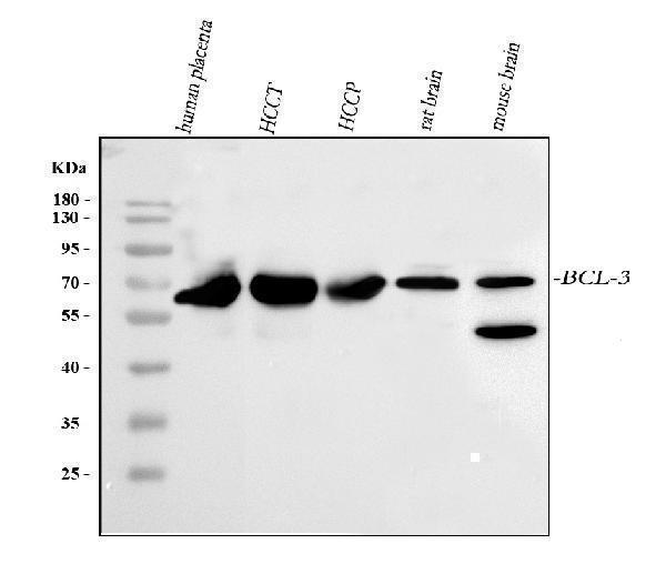  Western blot analysis of BCL3 using anti-BCL3 antibody (A02773-4)