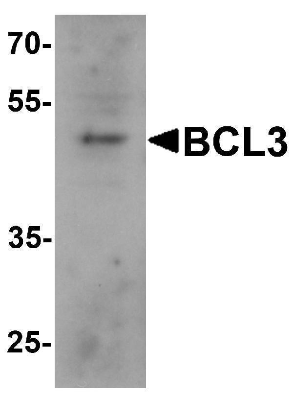 Western blot analysis of BCL3 in 293 cell lysate with BCL3 antibody at 1 μg/mL