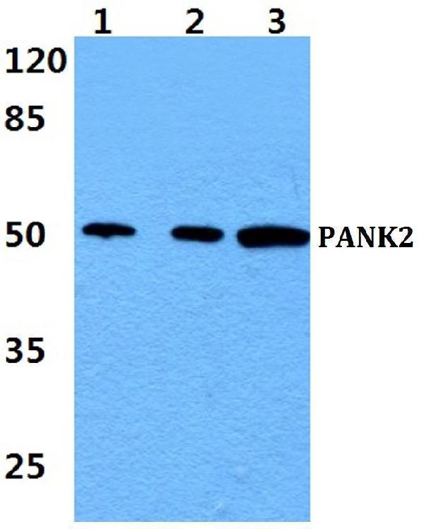 a02776 1 pank2 primary antiboties wb testing 1