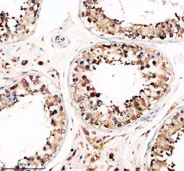 IHC analysis of TSN using anti-TSN antibody (A02777-3)