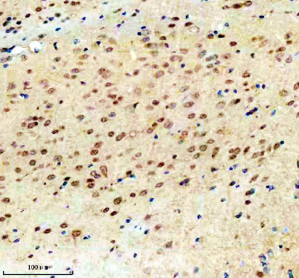 IHC analysis of TSN using anti-TSN antibody (A02777-3)