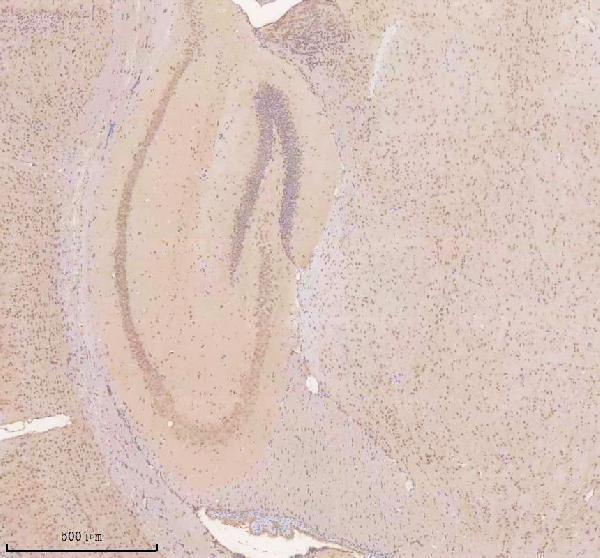 a02777 3 tsn primary antibodies ihc testing 3