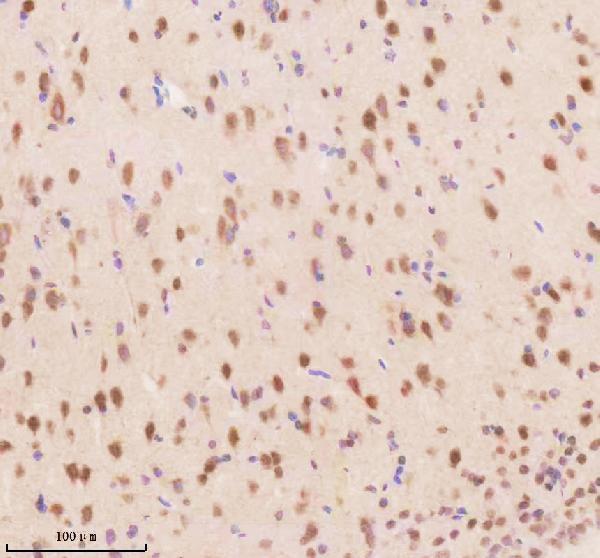 a02777 3 tsn primary antibodies ihc testing 4