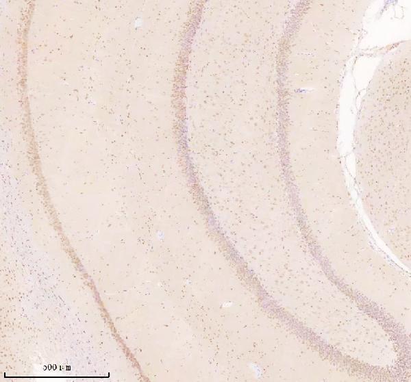 a02777 3 tsn primary antibodies ihc testing 5