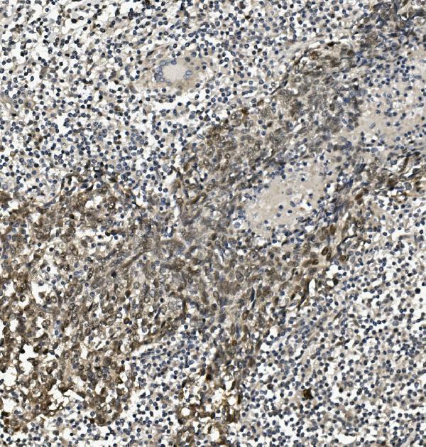  IHC analysis of HP1 alpha/CBX5 using anti-HP1 alpha/CBX5 antibody (A02780-3)