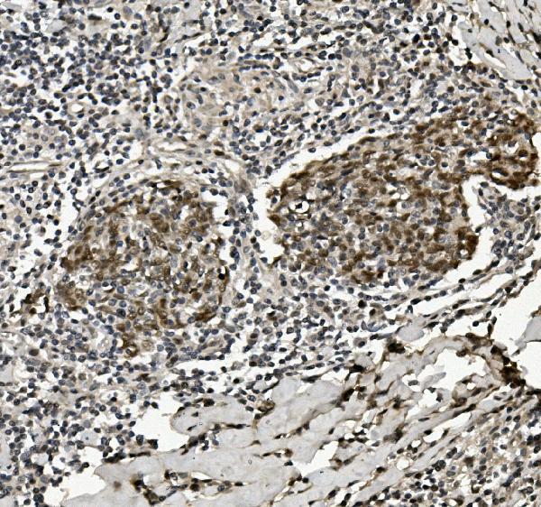  IHC analysis of HP1 alpha/CBX5 using anti-HP1 alpha/CBX5 antibody (A02780-3)