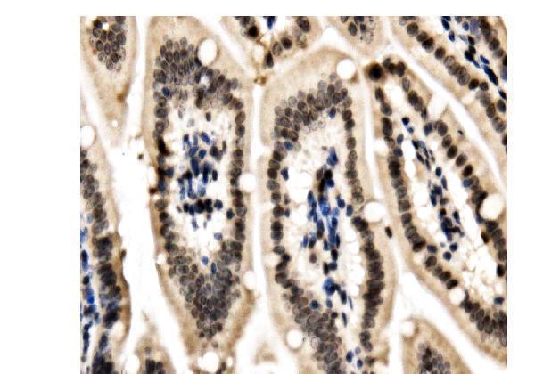 a02780 3 cbx5 primary antibodies ihc testing 5