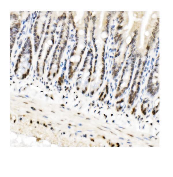 a02780 3 cbx5 primary antibodies ihc testing 6