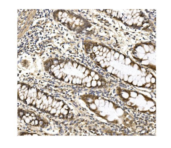  IHC analysis of Aconitase 1/ACO1 using anti-Aconitase 1/ACO1 antibody (A02781-1)
