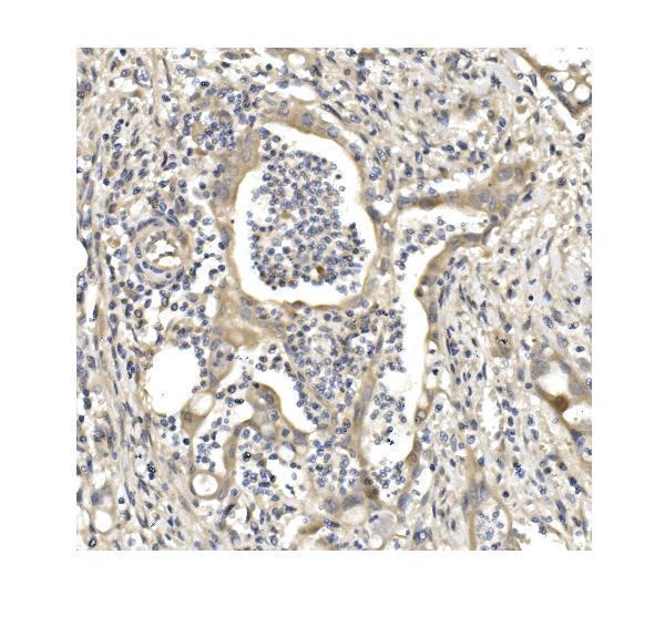  IHC analysis of Aconitase 1/ACO1 using anti-Aconitase 1/ACO1 antibody (A02781-1)