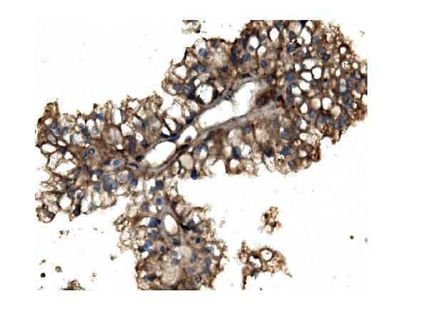 a02781 1 aco1 primary antibodies ihc testing 4