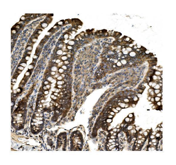 a02781 1 aco1 primary antibodies ihc testing 5