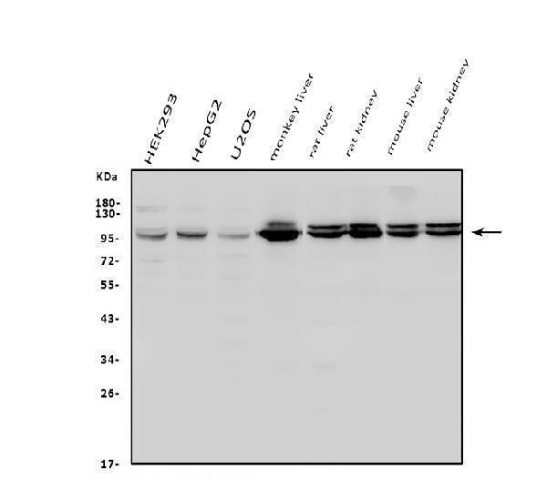  Western blot analysis of Aconitase 1/ACO1 using anti-Aconitase 1/ACO1 antibody (A02781-1)
