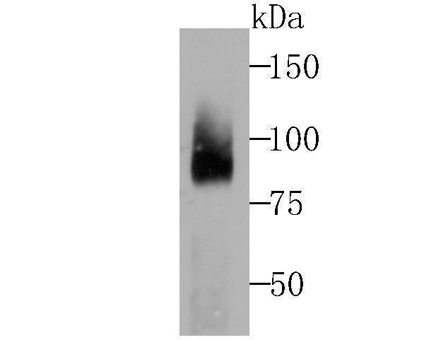 Western blot analysis of Coilin on rat kidney tissue lysates using anti-Coilin at 1/500 dilution