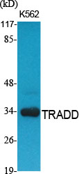 a02785 1 tradd primary antibodies wb testing 2