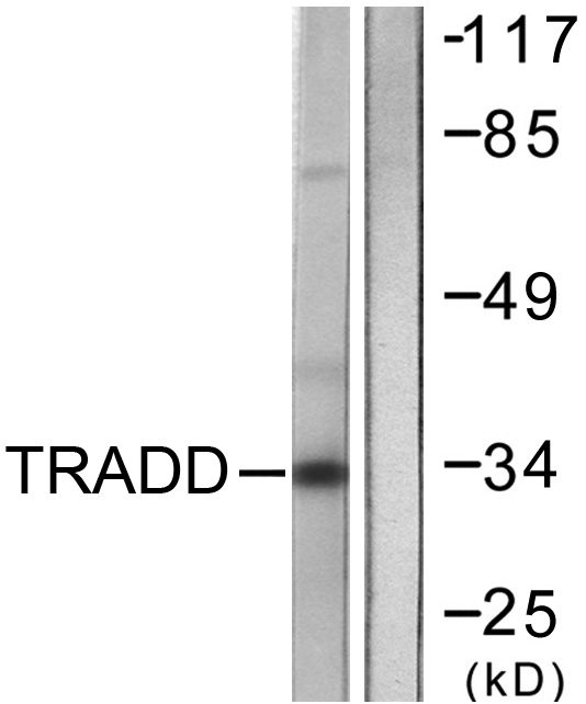 a02785 1 tradd primary antibodies wb testing 4