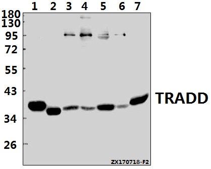 Western blot (WB) analysis of TRADD (L282) pAb at 1:500 dilution
Lane1:PC12 whole cell lysate(20ug)
Lane2:AML-12 whole cell lysate(20ug)
Lane3:MCF-7 whole cell lysate(40ug)
Lane4:HEK293T whole cell lysate(40ug)
Lane5:U-87MG whole cell lysate(40ug)
Lane6:HepG2 whole cell lysate(40ug)
Lane7:Hela whole cell lysate(40ug)