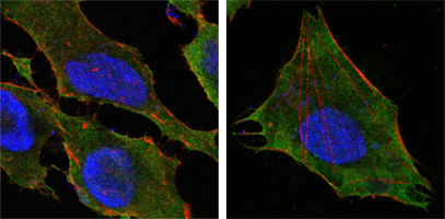 Confocal immunofluorescence analysis of Hela (left) and L-02 (right) cells using S-100A10 Monoclonal Antibody (green)