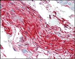 Immunohistochemistry analysis of paraffin-embedded human nerve and ganglion cells with AEC staining using S-100A10 Monoclonal Antibody