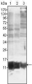 Western Blot analysis using S-100A10 Monoclonal Antibody against MCF-7 (1), HepG2 (2) and HeLa (3)