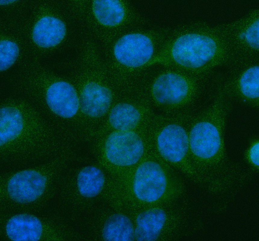 a02787 2 s100a10 primary antibodies if testing 1