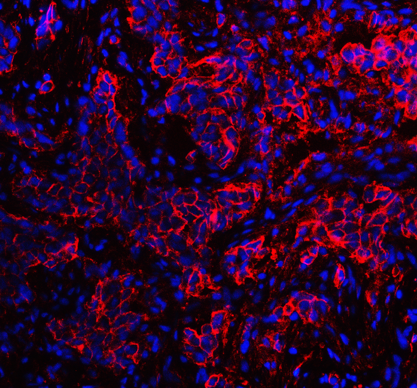 a02787 2 s100a10 primary antibodies if testing 2