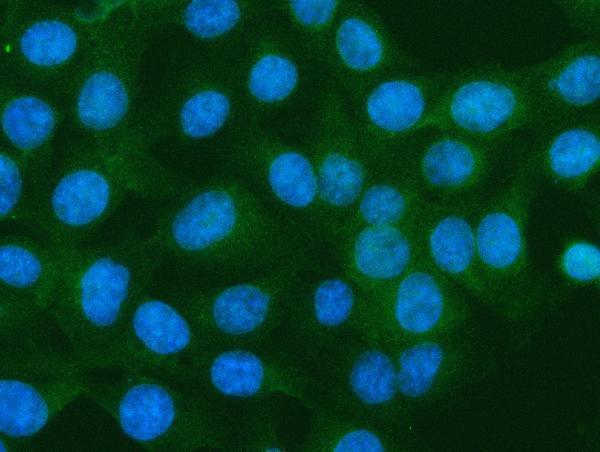 a02787 2 s100a10 primary antibodies if testing 8