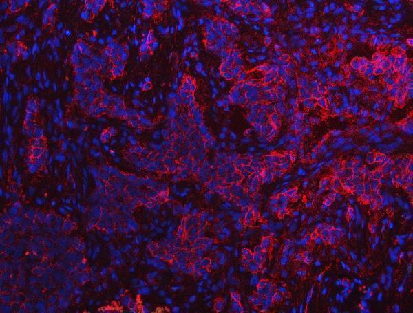 a02787 2 s100a10 primary antibodies if testing 9