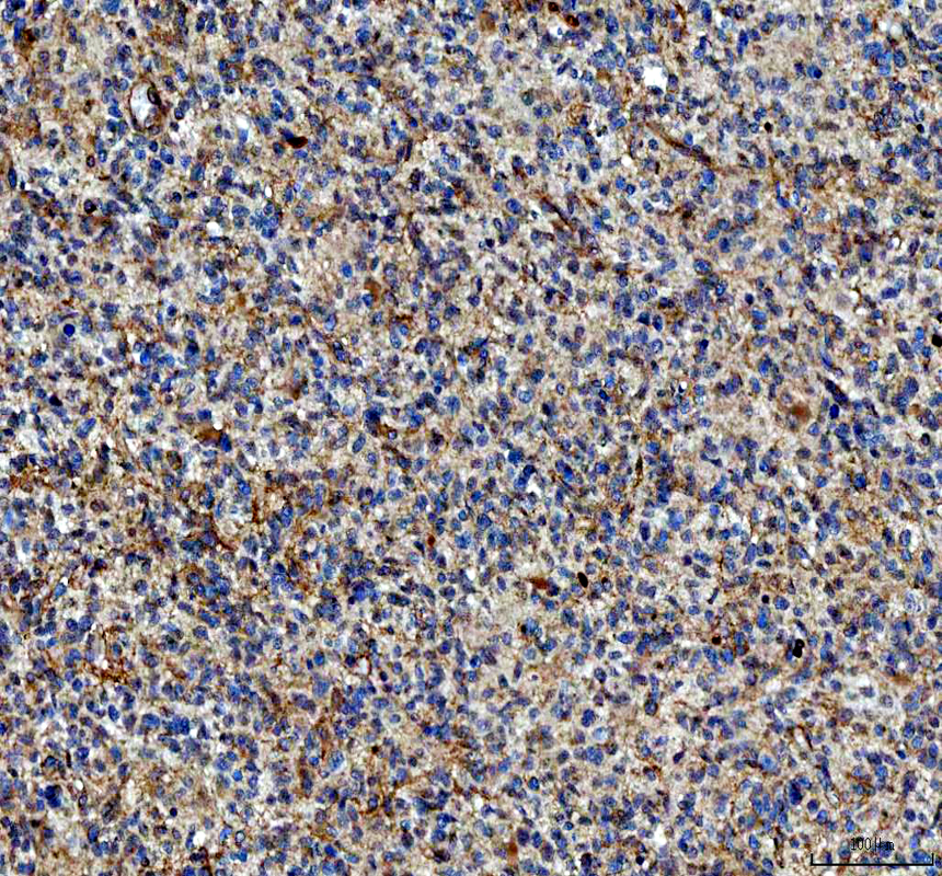 IHC analysis of S100A10 using anti-S100A10 antibody (A02787-2)