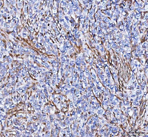  IHC analysis of S100A10 using anti-S100A10 antibody (A02787-2)