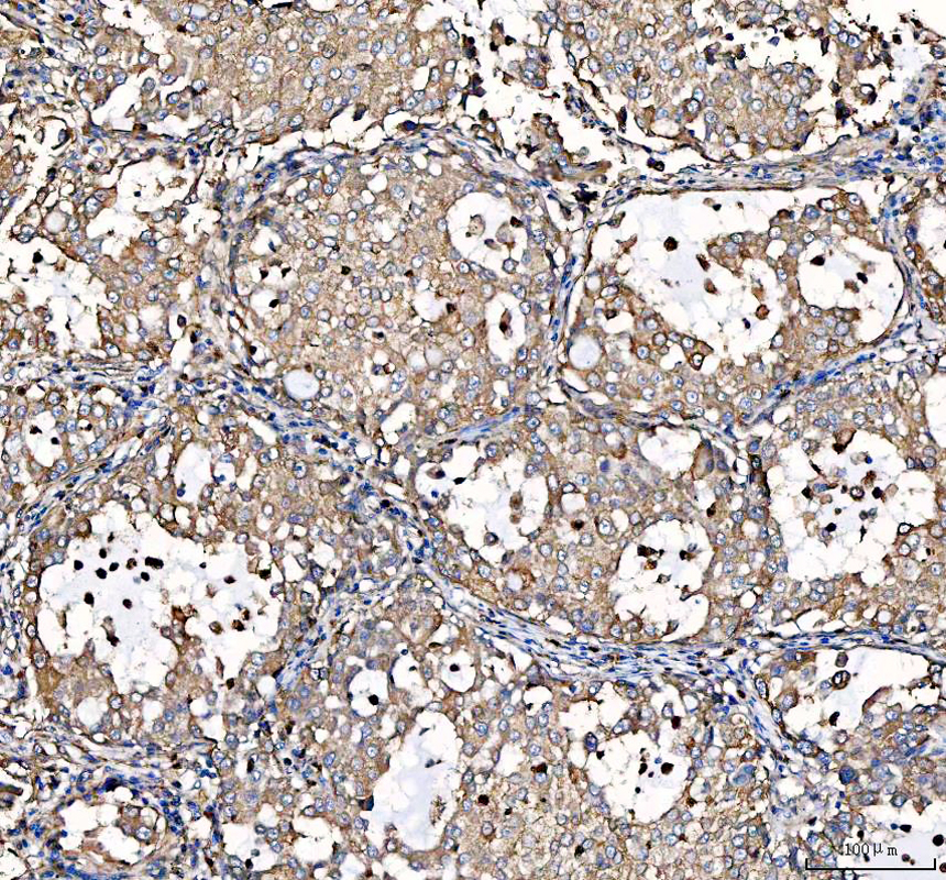 IHC analysis of S100A10 using anti-S100A10 antibody (A02787-2)
