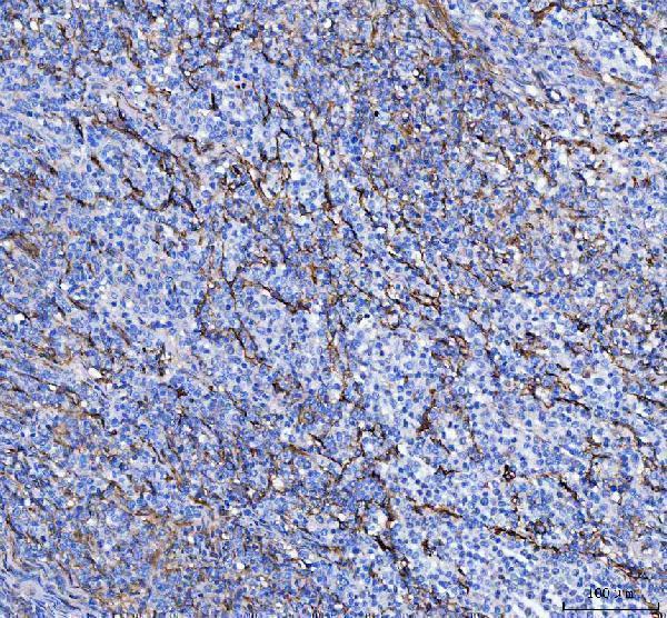  IHC analysis of S100A10 using anti-S100A10 antibody (A02787-2)