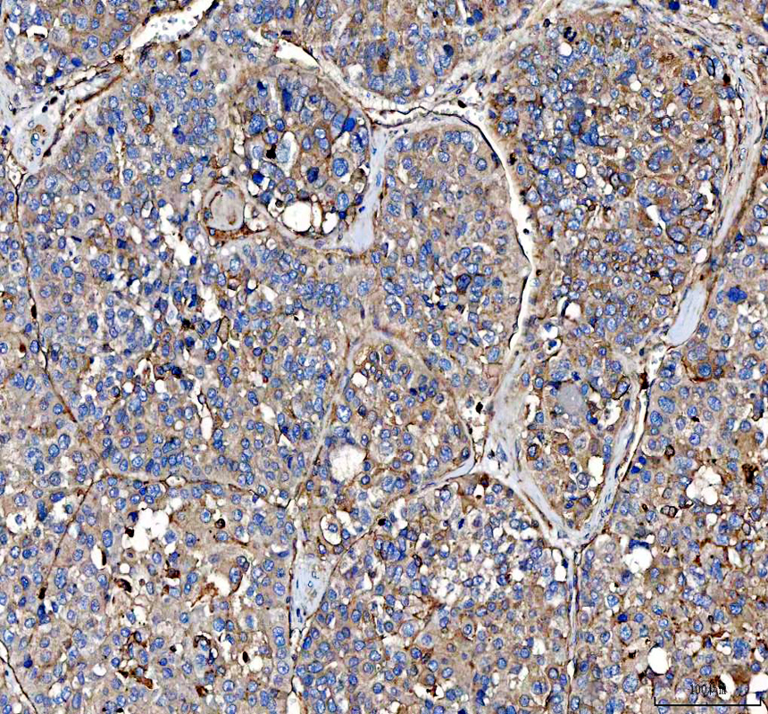 a02787 2 s100a10 primary antibodies ihc testing 3_1