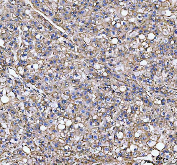 a02787 2 s100a10 primary antibodies ihc testing 4