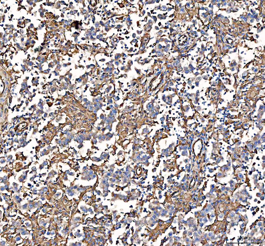 a02787 2 s100a10 primary antibodies ihc testing 4_1